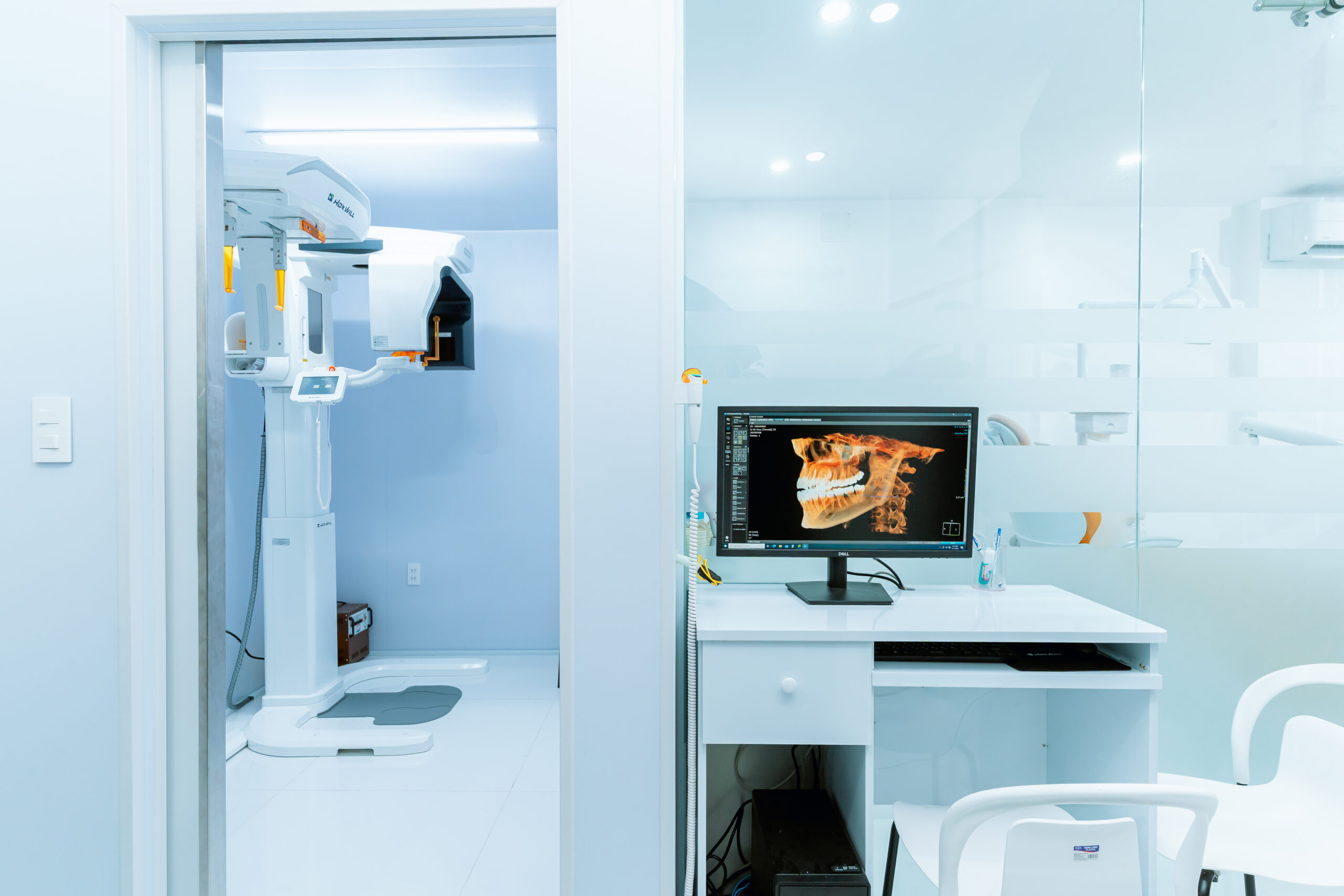 Chụp Phim Cone Beam CT – Công Nghệ Hình Ảnh 3D Tiên Tiến Trong Nha Khoa 5